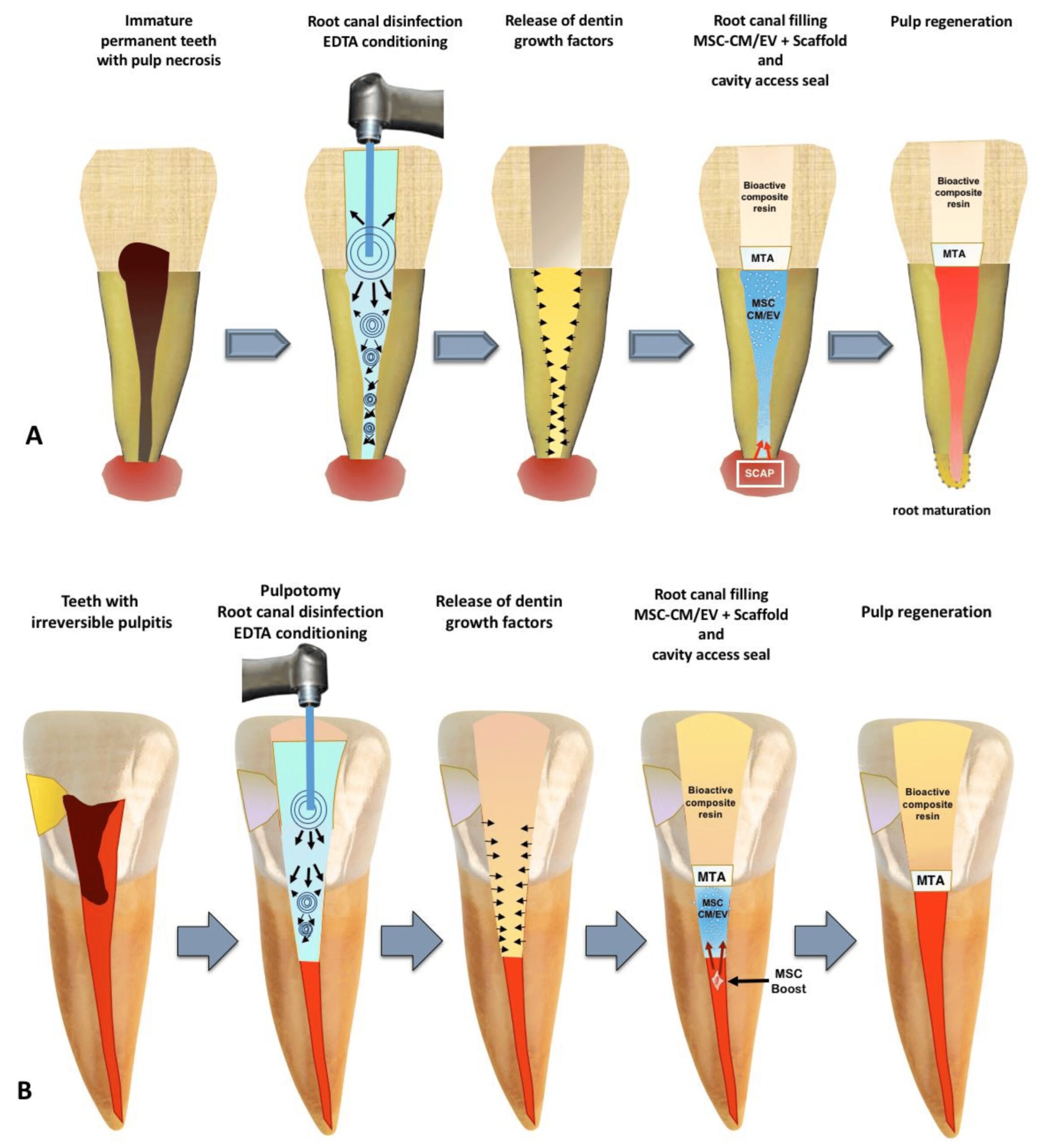 Regenerative Endodontics Regenerative Endodontics