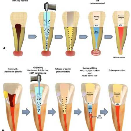 Regenerative Endodontics